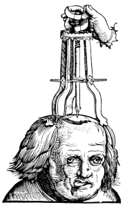 Trepanation_-_feldbuch-der_wundartzney